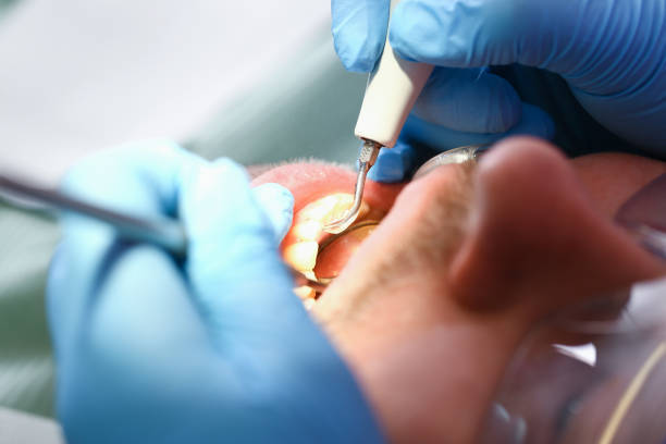 Best Emergency Gum Pain Relief  in Granite Bay, CA