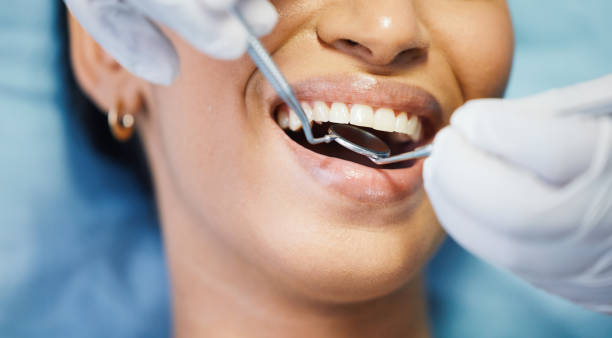 Best Emergency Tooth Extraction  in Granite Bay, CA